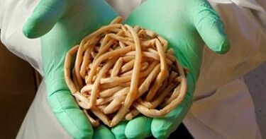 parassiti estratti dal corpo umano