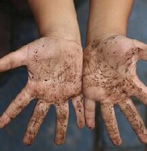 mani sporche come causa di vermi in un bambino