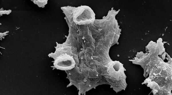 La Negleria fowlera è un protozoo parassita pericoloso per la vita umana. 